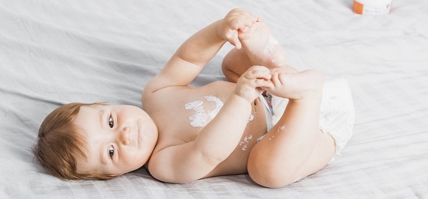 Apa Saja Penyebab Iritasi Pada Kulit Si Kecil? Segera Atasi Dengan Cara ini!